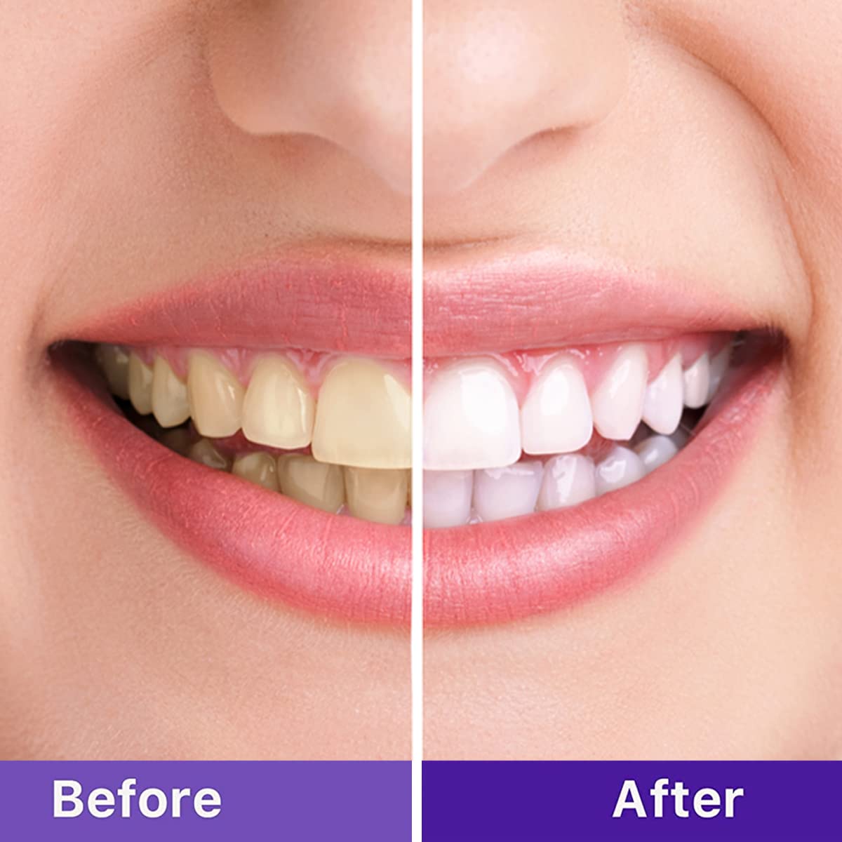 CREMA BLANQUEADORA DENTAL MORADA